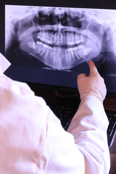 Best Emergency Root Canal Treatment in Hinckley, IL